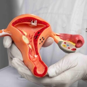 Experienced fibroids specialist in Mumbai at Fibroids India